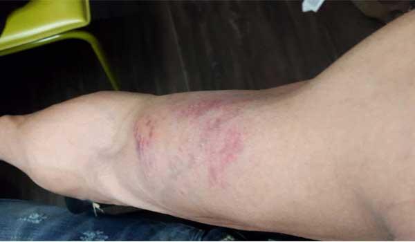 Sudheer Babu Injured