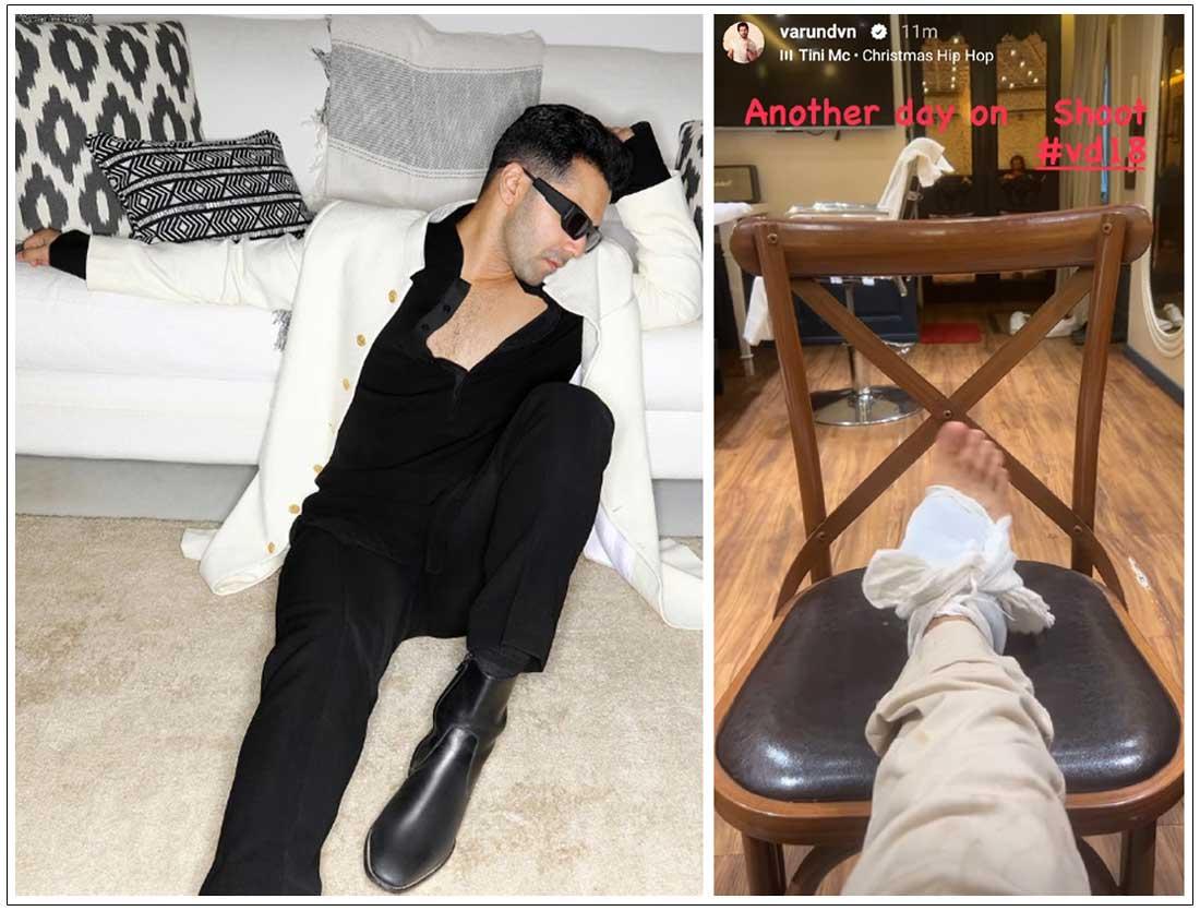 Varun Dhawan suffers injuries during VD18 shoot