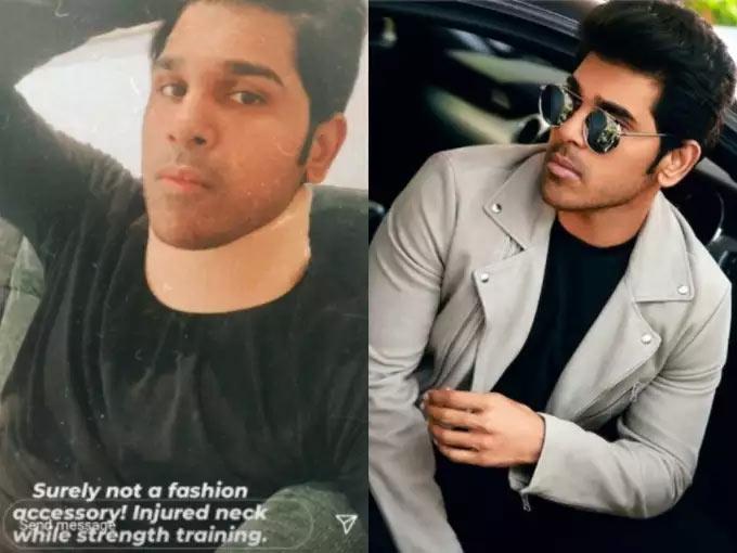 Allu Sirish suffers injury
