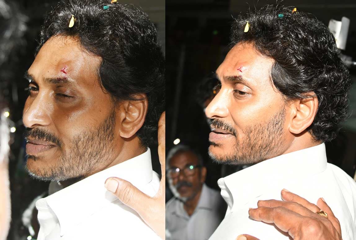CM Jagan Injured in Stone Attack