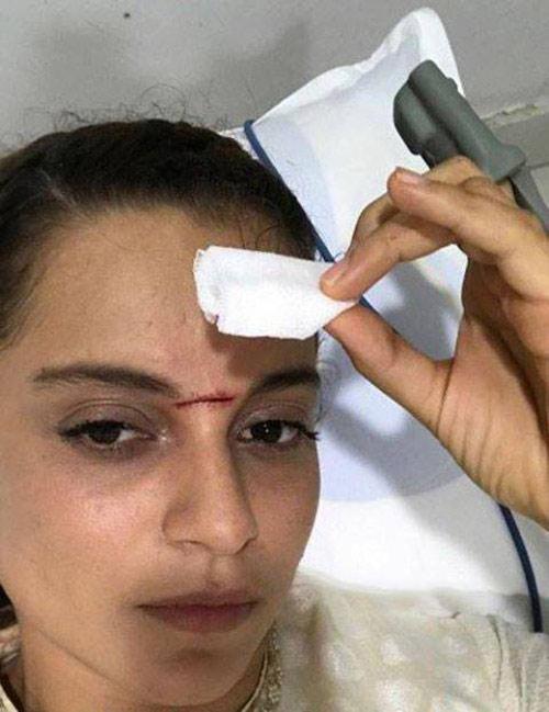 Kangna Ranaut Injured on Manikarnika Sets