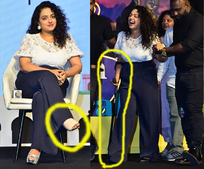 Nithya Menon Leg Fracture
