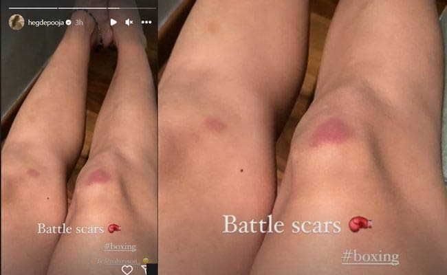 Pooja Hedge shared a story about her knee injuries