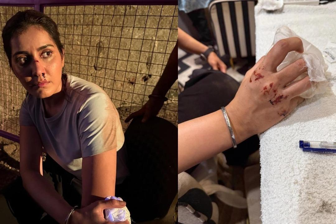 Rashi Khanna Shares Intense Training Photos with Visible Injuries