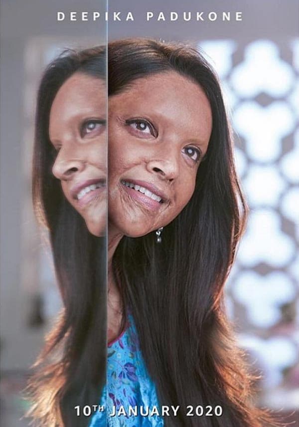 Pic Talk: Scars, Burns On Deepika Face
