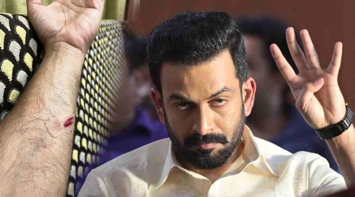 Prithviraj Sukumaran met with a minor accident