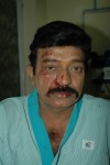 Rajasekhar in Chennai Apollo Hospital - 1 of 7