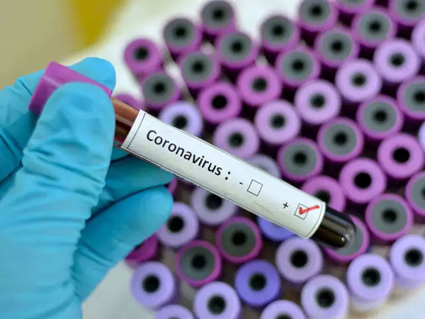 Andhra Pradesh 1 Million Coronavirus Tests