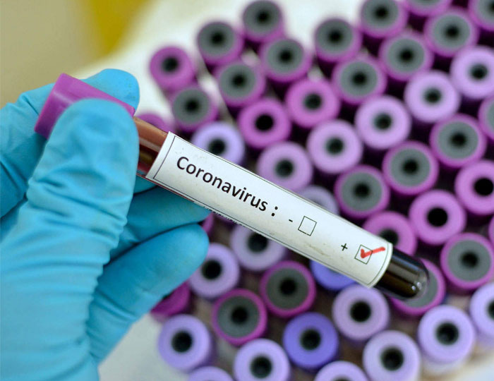 Coronavirus Positive and Death Count Records