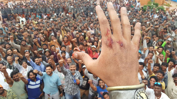 Prabhas Fingers Bleeding in Baahubali 2's Climax