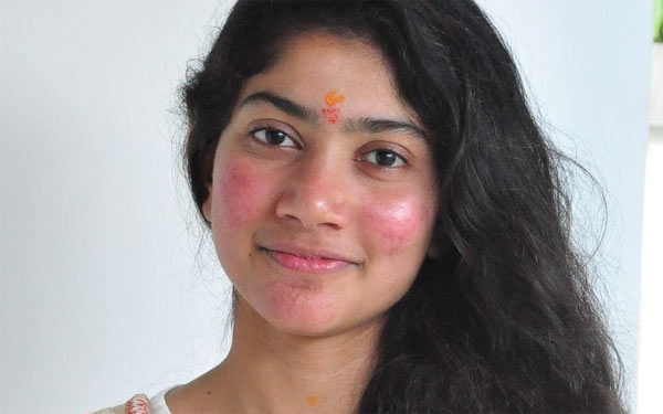 Sai Pallavi Pimples