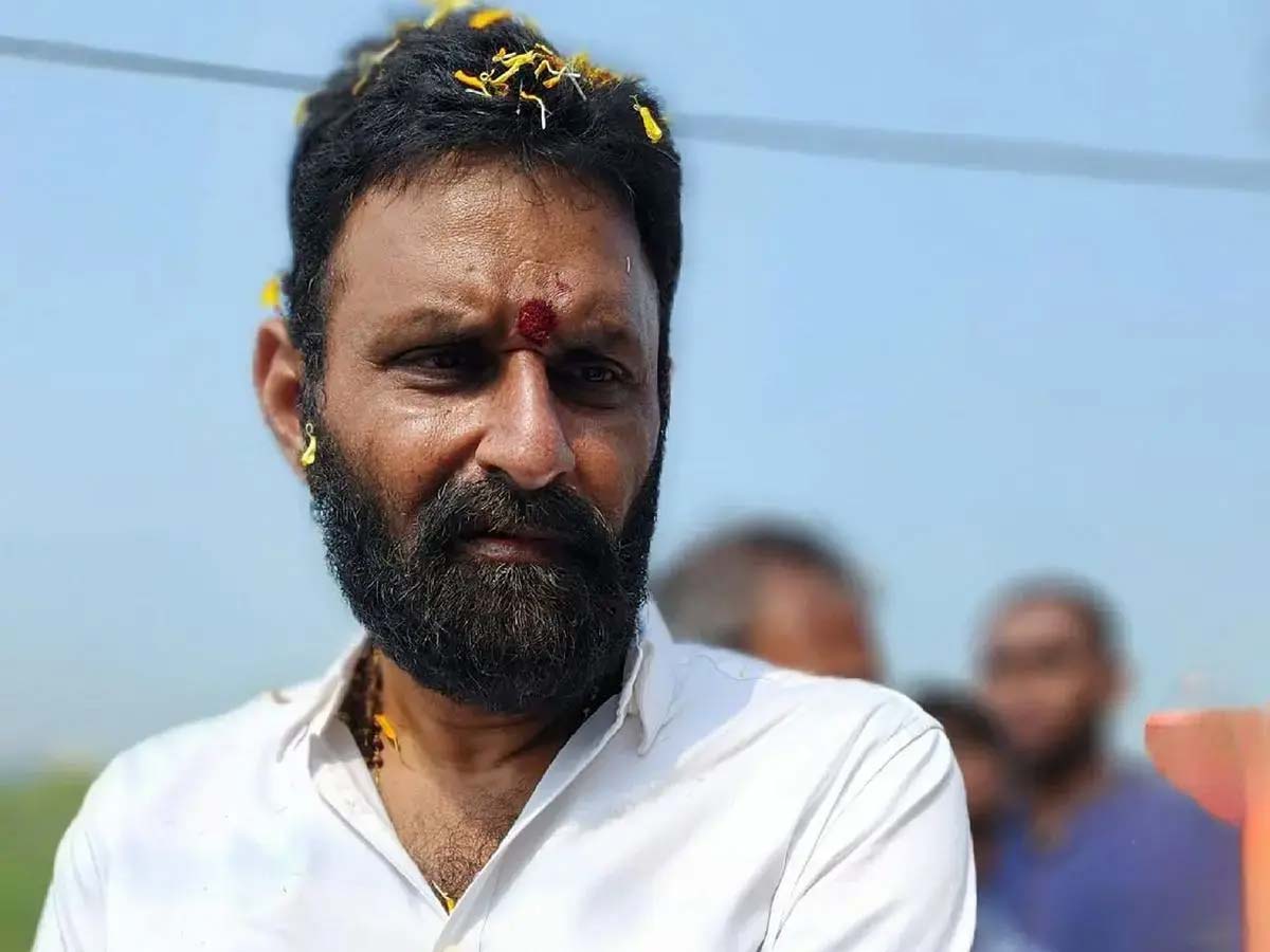 kodali nani  కొడాలి నాని కి హార్ట్ సర్జరీ పూర్తి 
