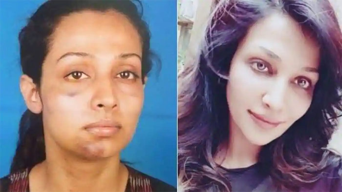 flora saini,accuses,producer,gaurang doshi,physical abuse  మాజీ ప్రియుడు.. హీరోయిన్‌ని ఇలా కొట్టాడేంటి?! 